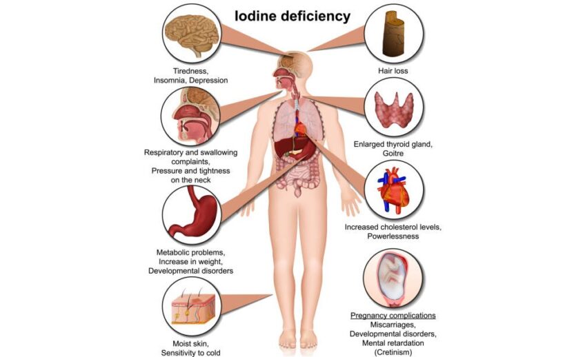 What Are The Symptoms Of Deficiency Disease Caused By Iodine