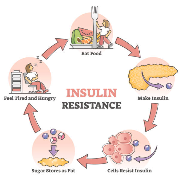 What Is Insulin Resistance Sujata Birla Hospital