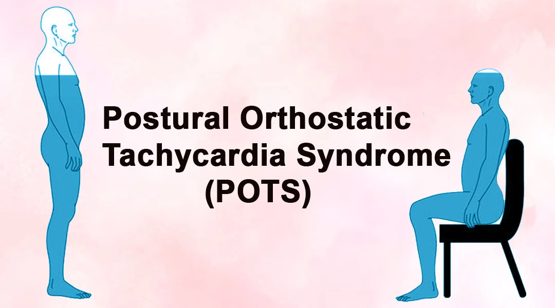 Symptoms of Postural Orthostatic Tachycardia Syndrome (POTS