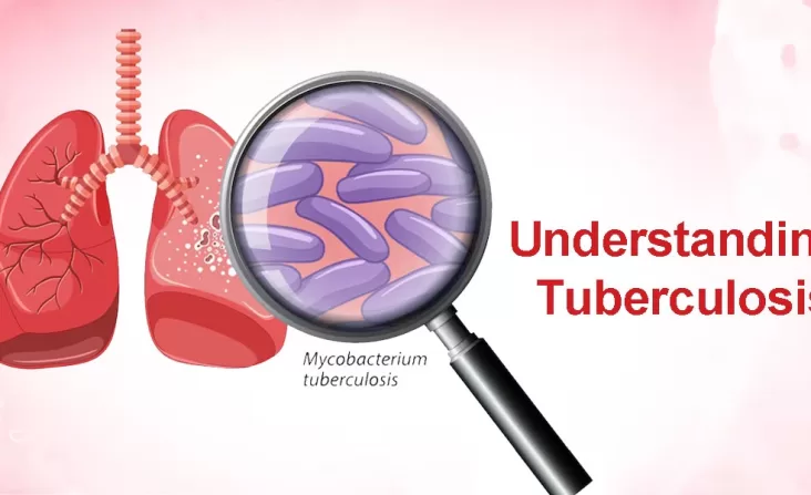 Understanding Tuberculosis: Symptoms, Prevention, and Treatment